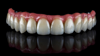 dental prosthesis made of ceramics and pink gum for the upper jaw on a black background with reflection © Dental Pro Content