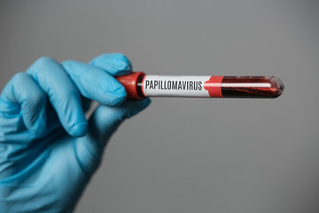 Obraz premium Nurse in rubber gloves Holding Blood Sample.