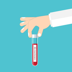 Coronavirus. Researcher hand holds a test tube with corona virus, analysis, or medicine to fight the epidemic.