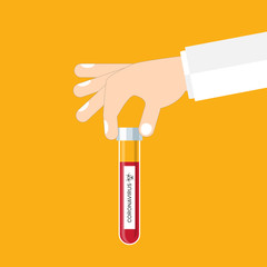 Coronavirus. Researcher hand holds a test tube with corona virus, analysis, or medicine to fight the epidemic.