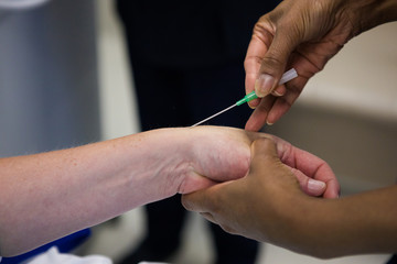Close up image of a doctor inserting an intravenous line, IV, into the arm of a sick patient