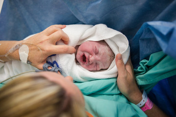Close up image of a newly born, covered in vernix baby in a hospital