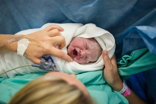 Close up image of a newly born, covered in vernix baby in a hospital