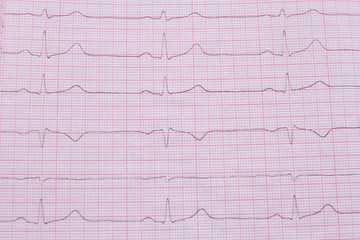 Close up of ECG cardiogram pulse graph on a paper. Medical examination cardiogram