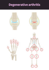 medical illustration for explain diseases