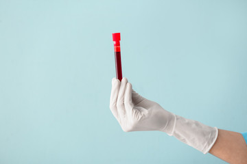 Doctor's hand holding test tube with blood sample on color background