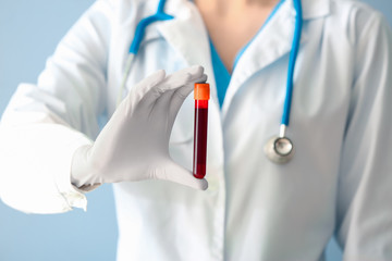 Doctor holding test tube with blood sample, closeup