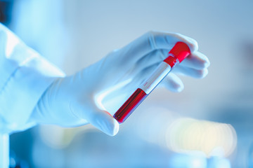 Doctor working with blood samples in laboratory
