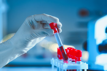 Doctor working with blood samples in laboratory