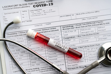 Blood test sample for COVID 19 virus