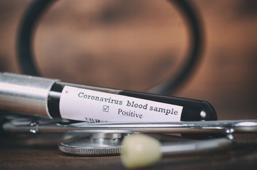 Coronavirus 2019-nCoV Blood Sample . Epidemic virus Respiratory Syndrome stock photo. Test tube...