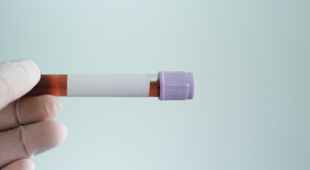 Hand of doctor holding test tube in hospital with copy space,covid-19 concept