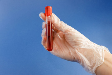 Hand holding testing patients blood samples for virus ion blue backgfound. New coronavirus...