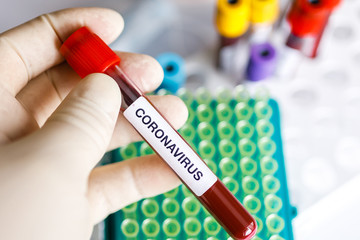 Covid 19 Coronavirus infected blood in tube in hand of scientist doctor biohazard protection clothing in coronavirus research laboratory. Coronavirus Covid-19 vaccine research.