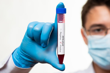 Test tube in male hand close up, doctor in medical mask holding vial with red liquid. Concept blood...