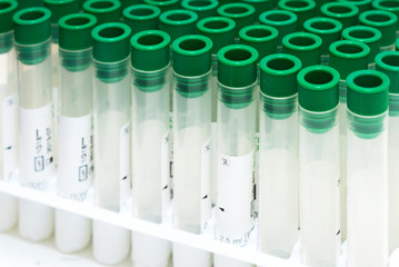 Covid-19 outbreak blood test. Close up view of empty test tubes for blood samples of Coronavirus patients, on a rack .