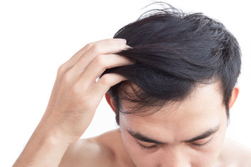 Fototapeta premium Young man serious hair loss problem for health care medical and shampoo product concept, selective focus