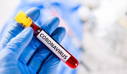 Obraz premium Doctor holding a positive blood test result of coronavirus.