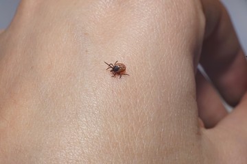 Female tick ( Ixodes scapularis) crawling on skin ready to bite 