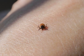 Female tick ( Ixodes scapularis) crawling on skin ready to bite 