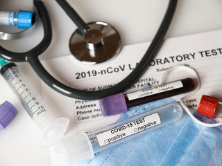 Coronavirus COVID-2019 test concept