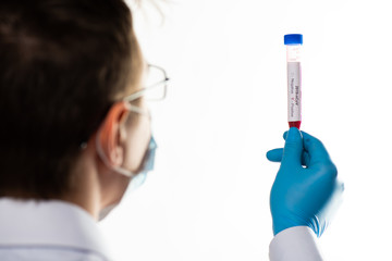 Test tube in male hand close up, doctor in medical mask holding vial with red liquid. Concept blood...