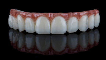 beautiful macro photo of a dental prosthesis of the upper jaw on black glass with reflection © Dental Pro Content