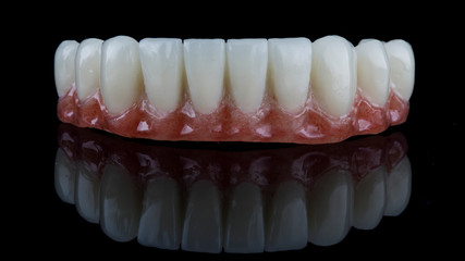 excellent macro photo of a dental lower jaw prosthesis on black glass