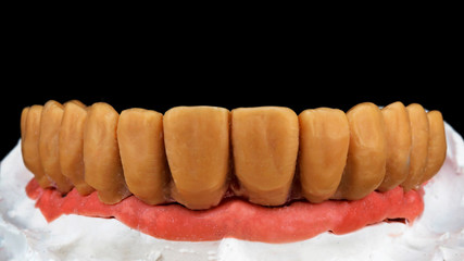 Naklejka premium wax wax denture on model and pink gum