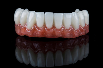 excellent dental prosthesis of the lower jaw of the exact dental polymer, shot on a black background