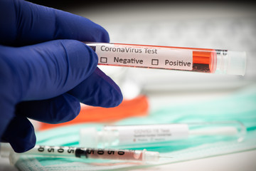 Fototapeta premium Blood test for COVID-19. Examination of a blood sample for the presence of SARS-CoV-2 coronavirus