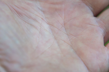 Lines on the open palm of a person. Guessing on the arm.