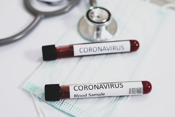COVID-19 text with stethoscope and blood sample vacuum tube ,Covid or Coronavirus Concept