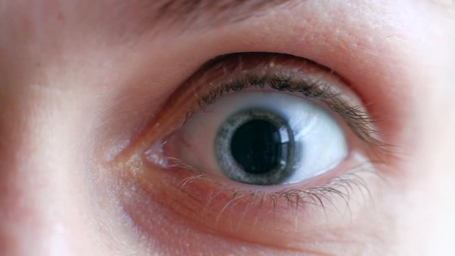 Close up of a female blue eye with dilated pupil. Detail of a goggle blue eye of a woman looking at camera. 4k. Concept of healthy vision. Eye drops after a visit to an ophthalmologist.
