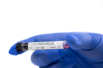 Obraz premium Hand with blue protective gloves holds blood sample tested positive with coronavirus