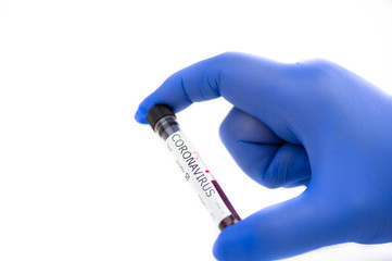 Hand with blue protective gloves holds blood sample tested positive with coronavirus