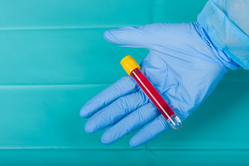 Doctor holding test tube with blood for 2019-nCoV analyzing. Novel Chinese Coronavirus blood test Concept.