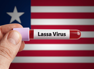 Nigeria based Lassa virus or Lassa fever is relatively common in Nigeria, Liberia, Sierra Leone, Guinea and Ghana. Scientist holding Lassa virus infected blood in test tube in front of Liberia flag.