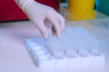 Hands in gloves arrange patient biopsy sections in plastic tubes. high throughput automatic...