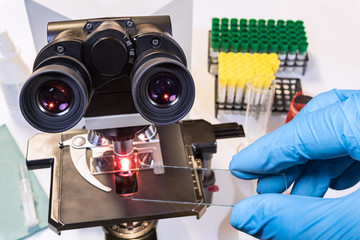 Coronavirus disease. Medical sample on a microscope slide in doctor hand in blue glove. Covid-19 outbreak. Laboratory equipment as optical diagnostic instrument, test tubes in racks and lab glassware.