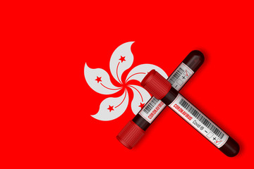 Test tubes with the Inscription 2019-nCoV on the background of the Hong Kong Flag. 3D Rendering