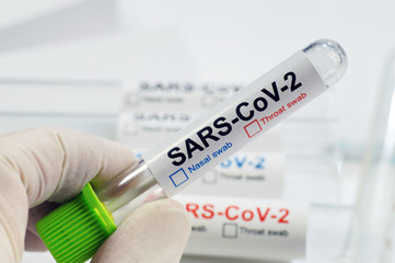 Tests for the presence of coronavirus in the body. The lab technician shows a vial with a nasal or throat swab. COVID -19 (SARS CoV-2).