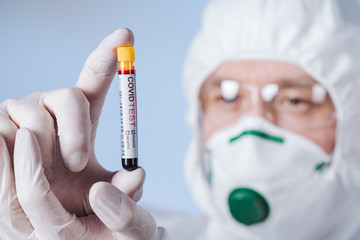 Doctor with a tube of biological sample contaminated by Coronavirus with label Covid Test. A...