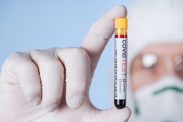 Microbiologist with a tube of biological sample contaminated by Coronavirus with label Covid Test....