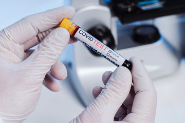 Positive result. A tube with a blood holds a hand in silicone gloves in a policlinic. A...