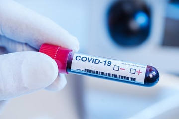Blood test tube for 2019 nCoV analysis. Coronavirus COVID-19 vaccine glass bottle in the...