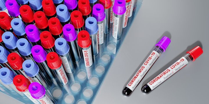 Coronavirus, SARS-CoV-2, Covid-19 virus - test tubes, blood tests - 3D illustration
