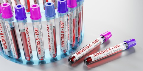 Hepatitis B virus - test tubes, blood tests - 3D illustration