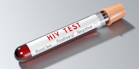 Fototapeta premium HIV virus/ AIDS - test tube, blood test - 3D illustration