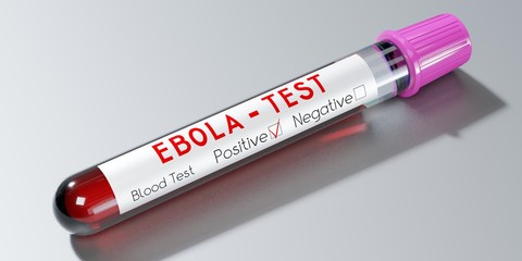 Fototapeta premium Ebola virus - test tube, blood test - 3D illustration